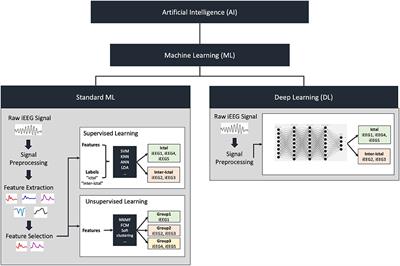 Decoding Intracranial EEG With Machine Learning: A Systematic Review
